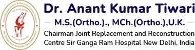 Dr. Anant Kumar Tiwari - Orthopaedic Surgeon Delhi